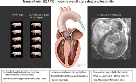 ventricular outflow tract obstruction treatments